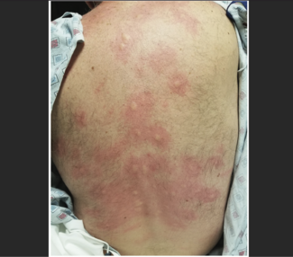 Kern contrast media thumbnail