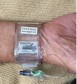 Seto STAT2 Thumbnail