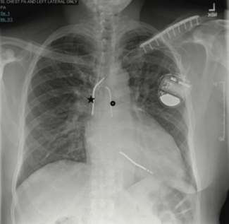 Shah Azygos thumbnail