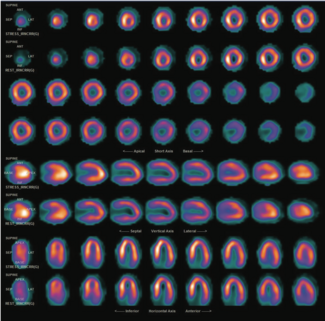 Ahmed COVID-19 thumbnail