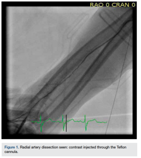 CLDSanghviFig1 July 2013