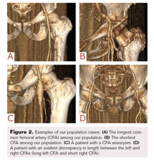 Figure 2. Population cases
