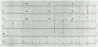 Kneller CRT-D Platform thumbnail
