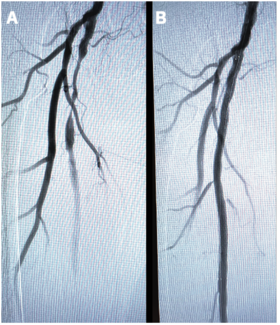 Markiewicz Radial Interventions thumbnail