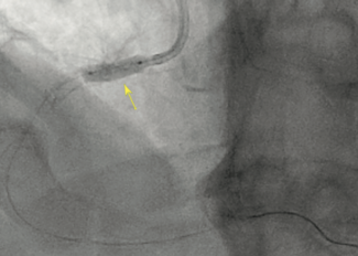 CLD Potluri Nov 2021