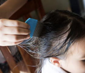 lice in child