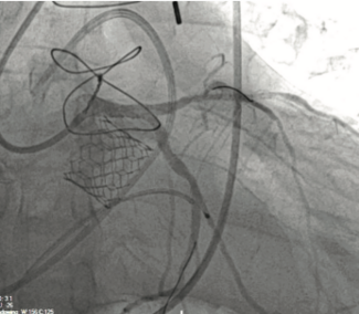 CLDBakhshetal_Dec2021