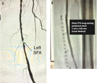 Casazza DRAT thumbnail