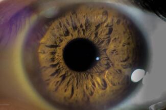 Eyeball