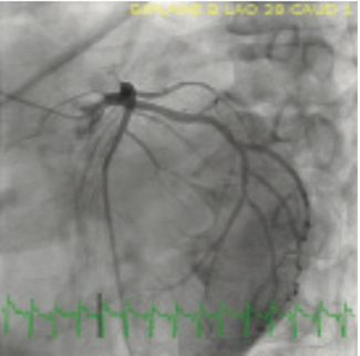 Seto Defibrillator TN