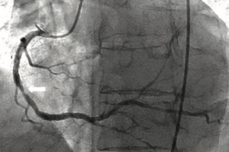 Heuser SyncVision TN