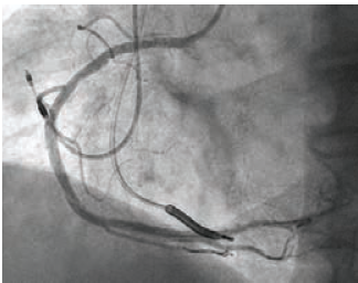 Gurevich CLD Jan 2022