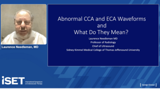 Abnormal CCA and ECA Waveforms