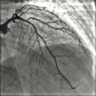 Ali Physiological Assessment TN