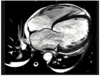 KellyAraj Heart Failure TN