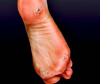 Top 10 Skin Conditions of the Lower Extremity