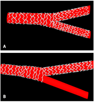 Ding Bifurcation Figure 1