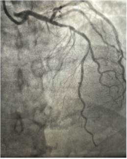 Lata Defibrillator TN