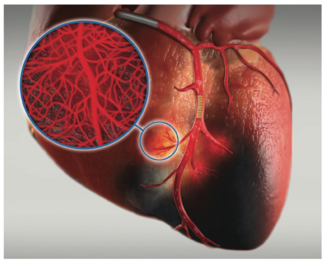 QuesadaStJohn SuperSaturated Oxygen Figure 1