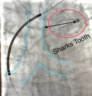 Shark's Tooth Casazza CLD