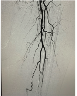 Tai Transcollateral Figure 1