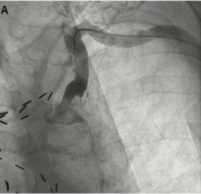 KernCLDMay 2022 Fig 1A
