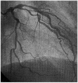 Lichaa Gadolinium Figure 2
