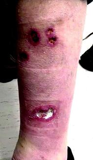 Dermatology Diagnosis