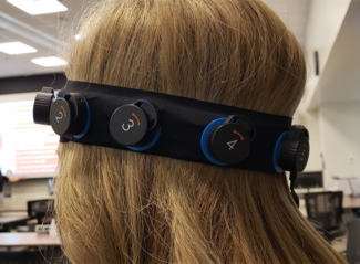Roughly the size of a portable radio, the Ceribell is a portable rapid-response EEG device. It has a special headband that facilitates electrode placement, making it easy enough for anyone to apply. 