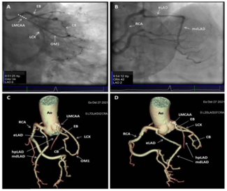 Karelas ACAOS Figure 1