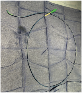 Ajmal Aortic Pressure Gradient Figure 1