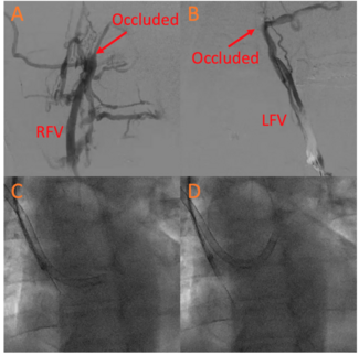 Chiang Deep Vein Thrombosis Figure 1A