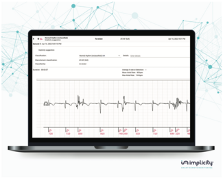 Implicity Artificial Intelligence Figure 1