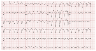 Kwaku Implantable Device Figure 