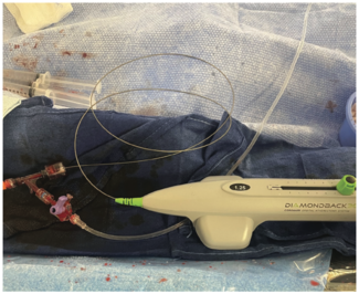 Whitbeck Glide Assist TN