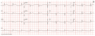 Bhattad Pericarditis Figure 1