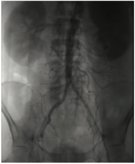 Gbur Multivessel Figure 1