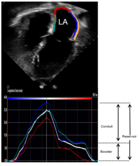 Egbe Left Atrial Strain TN