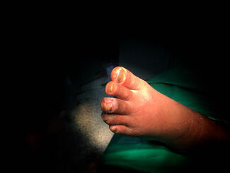 A Closer Look at a Novel Device for Foot Offloading