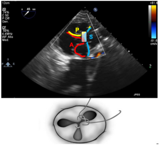 Nerla TriClip Figure 3
