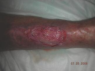 CMS Releases 2023 Medicare Physician Fee Schedule