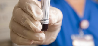 blood test+test vial