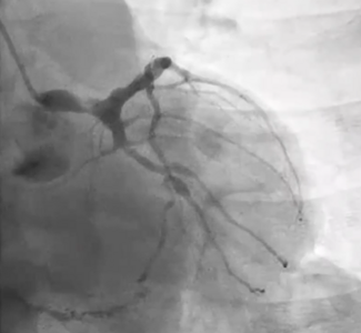 CLD Discussions: Drs Kern and Lim