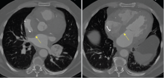 Lugo Fagundo RA Biopsy