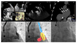 Rivero-Santana Fig 1