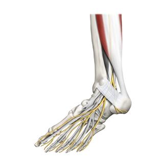 Can Tarsal Tunnel Decompression Treat Digital Contractures? 