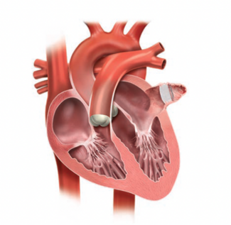 Speiser et al Figure 1