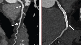 Ezad Vascular Scaffolds Figure 1