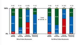 Meneguz-Moreno Balloon Commissurotomy Figure 2
