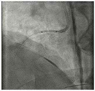 Shah Balloon Uncrossable Figure 2